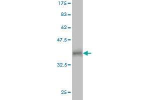 Western Blot detection against Immunogen (37. (RNF17 antibody  (AA 30-139))