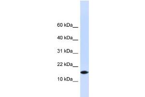 WB Suggested Anti-PHLDA3 Antibody Titration: 0. (PHLDA3 antibody  (N-Term))
