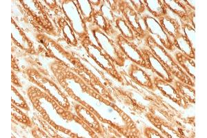 Formalin-fixed, paraffin-embedded human Renal Cell Carcinoma stained with Calnexin Mouse Monoclonal Antibody (CANX/1541). (Calnexin antibody  (N-Term))