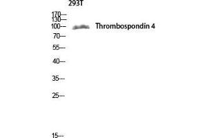 Western Blot (WB) analysis of 293T lysis using Thrombospondin 4 antibody. (THBS4 antibody  (Internal Region))