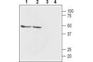 Western Blotting (WB) image for anti-gamma-aminobutyric Acid (GABA) A Receptor, Subunit beta 1 (GABRB1) (AA 345-358) antibody (ABIN7043194)