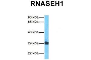 Host:  Rabbit  Target Name:  RNASEH1  Sample Tissue:  Human Jurkat  Antibody Dilution:  1. (Ribonuclease H1 antibody  (Middle Region))