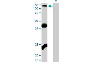 Western Blot analysis of EPHB3 expression in transfected 293T cell line by EPHB3 monoclonal antibody (M01), clone 1B3. (EPH Receptor B3 antibody  (AA 899-997))