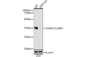 Western blot analysis of extracts from wild type (WT) and SM/SNF5 knockout (KO) 293T cells, using SM/SNF5 antibody (ABIN7270657) at 1:1000 dilution. (SMARCB1 antibody)