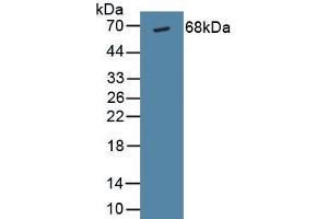 Detection of Recombinant Albumin, Human using Polyclonal Antibody to Albumin (ALB) (Albumin antibody)