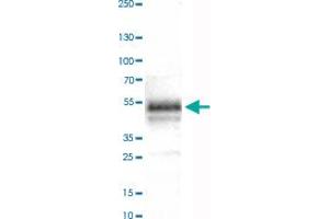 Western Blot analysis of human tonsil tissue lysate with CA12 monoclonal antibody, clone CL0278 .