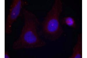 Immunofluorescence staining of methanol-fixed Hela cells using Pyk2(Phospho-Tyr402) Antibody. (PTK2B antibody  (pTyr402))