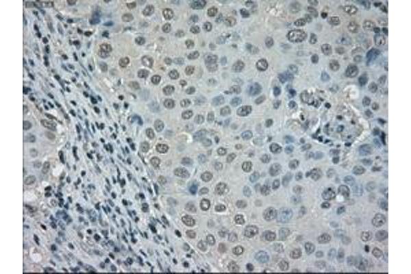 Dihydrofolate Reductase antibody