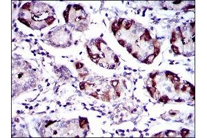 Immunohistochemical analysis of paraffin-embedded stomach tissues using SLC27A5 mouse mAb with DAB staining. (SLC27A5 antibody  (AA 508-570))
