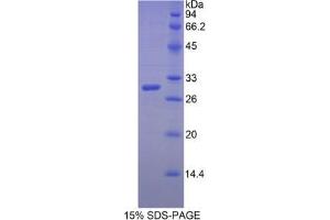 SDS-PAGE analysis of Human MYH3 Protein. (MYH3 Protein)