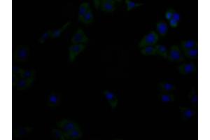 Immunofluorescence staining of Hela cells with(ABIN7176749)at 1:90, counter-stained with DAPI. (Histone 3 antibody  (AA 21-228))