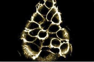 Immunofluorescent staining of A431 cell line with beta-Catenin antibody. (beta Catenin antibody  (AA 571-781))