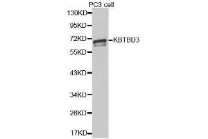 Western blot analysis of extracts of PC-3 cells, using KBTBD3 antibody. (KBTBD3 antibody  (AA 410-607))