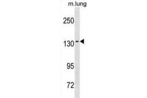 Western Blotting (WB) image for anti-SEC31 Homolog A (SEC31A) antibody (ABIN3001341) (SEC31A antibody)