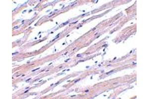 Immunohistochemistry of APAF1 in human heart tissue with APAF1 polyclonal antibody  at 1 ug/mL .