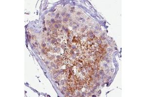 Immunohistochemical staining (Formalin-fixed paraffin-embedded sections) of human testis with PCM1 monoclonal antibody, clone CL0206  shows moderate immunoreactivity in seminiferous tubules.