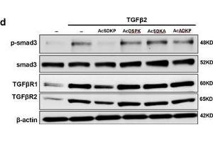 Western Blotting (WB) image for anti-SMAD, Mothers Against DPP Homolog 3 (SMAD3) (pSer423), (pSer425) antibody (ABIN129675)