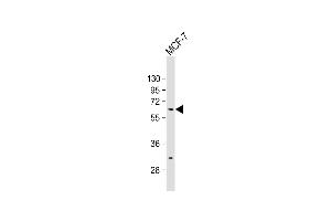 Anti-ZN Antibody (N-term) at 1:500 dilution + MCF-7 whole cell lysate Lysates/proteins at 20 μg per lane. (ZNF835 antibody  (N-Term))