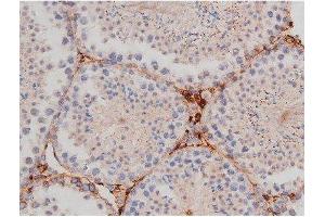 Immunohistochemistry (IHC) image for anti-Microtubule-Associated Protein tau (MAPT) (pThr181) antibody (ABIN6255614)