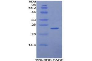 SDS-PAGE analysis of Human Intercellular Adhesion Molecule 4 Protein. (ICAM4 Protein)
