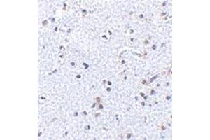 Immunohistochemistry of TSLP in human brain tissue with this product at 2. (Thymic Stromal Lymphopoietin antibody  (C-Term))