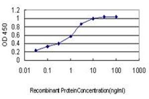 Detection limit for recombinant GST tagged ACACA is approximately 0. (Acetyl-CoA Carboxylase alpha antibody  (AA 1-99))
