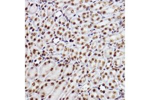 Immunohistochemistry of paraffin-embedded mouse kidney using GTF2F2 Rabbit mAb (ABIN7267373) at dilution of 1:100 (40x lens). (GTF2F2 antibody)