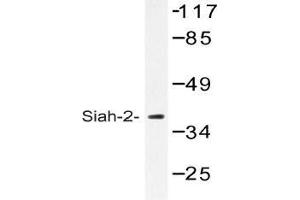 Western blot (WB) analysis of Siah-2 antibody in extracts from COLO cells.