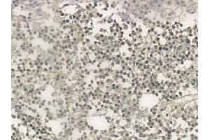 ABIN6257578 and ABIN6273604 at 1/100 staining human pituitary adenoma by IHC-P. (ZNF71 antibody  (N-Term))