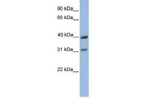 COX3 antibody used at 1 ug/ml to detect target protein. (COX3 antibody  (C-Term))