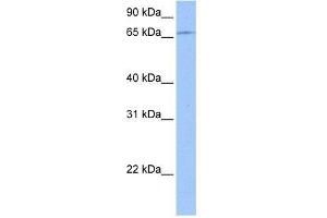 ZNF317 antibody used at 1. (ZNF317 antibody  (C-Term))
