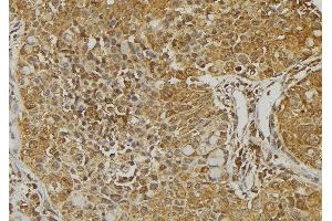 ABIN6273221 at 1/100 staining Human pancreas tissue by IHC-P. (CXCL14 antibody  (Internal Region))