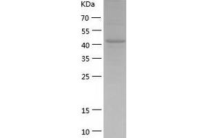 Western Blotting (WB) image for Nucleotide Exchange Factor SIL1 (SIL1) (AA 32-461) protein (His tag) (ABIN7124234) (SIL1 Protein (AA 32-461) (His tag))