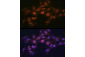 Immunofluorescence analysis of NIH-3T3 cells using WAPL Rabbit mAb (ABIN7271380) at dilution of 1:100 (40x lens). (WAPAL antibody)
