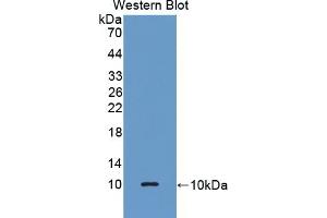 Detection of Recombinant GPX3, Human using Polyclonal Antibody to Glutathione Peroxidase 3, Plasma (GPX3) (GPX3 antibody  (AA 21-72))