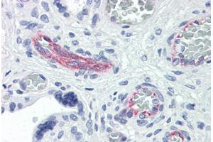Human Placenta: Formalin-Fixed, Paraffin-Embedded (FFPE) (RND3 antibody  (AA 1-245))