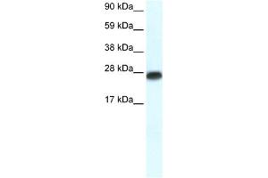 WB Suggested Anti-MYF6 Antibody Titration:  0. (MYF6 antibody  (N-Term))