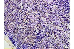 Immunohistochemistry (Paraffin-embedded Sections) (IHC (p)) image for anti-Protein Kinase, AMP-Activated, beta 1 Non-Catalytic Subunit (PRKAB1) (AA 201-270) antibody (ABIN737901)
