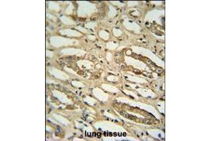 GGTLC2 antibody immunohistochemistry analysis in formalin fixed and paraffin embedded human lung tissue followed by peroxidase conjugation of the secondary antibody and DAB staining. (GGTLC2 antibody  (AA 127-154))