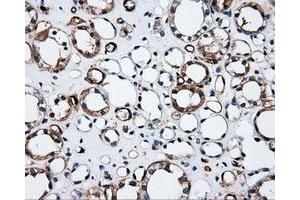Immunohistochemical staining of paraffin-embedded Kidney tissue using anti-CD36mouse monoclonal antibody. (CD36 antibody)