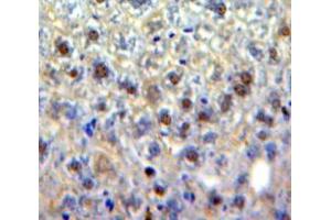 Used in DAB staining on fromalin fixed paraffin-embedded Liver tissue (EGR4 antibody  (AA 231-474))