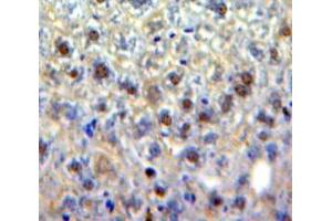 Used in DAB staining on fromalin fixed paraffin-embedded Liver tissue (EGR4 antibody  (AA 231-474))
