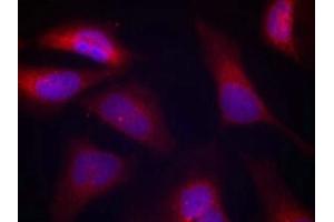 Immunofluorescence staining of methanol-fixed Hela cells using PKR(Phospho-Thr446) Antibody. (EIF2AK2 antibody  (pThr446))
