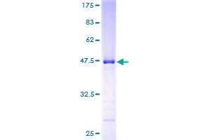 NKIRAS2 Protein (AA 1-191) (GST tag)