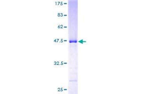 NKIRAS2 Protein (AA 1-191) (GST tag)