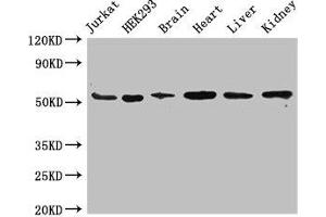 Western Blot Positive WB detected in: Jurkat whole cell lysate, HEK293 whole cell lysate, Mouse brain tissue, Mouse heart tissue, Mouse liver tissue, Mouse kidney tissue All lanes: SLC18A2 antibody at 3. (SLC18A2 antibody  (AA 463-514))