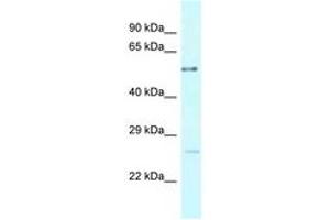 Image no. 1 for anti-Ectonucleoside Triphosphate diphosphohydrolase 3 (ENTPD3) (AA 275-324) antibody (ABIN6747780) (ENTPD3 antibody  (AA 275-324))