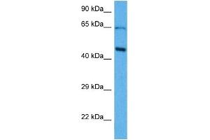 Host:  Mouse  Target Name:  SOX18  Sample Tissue:  Mouse Brain  Antibody Dilution:  1ug/ml (SOX18 antibody  (Middle Region))