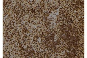 ABIN6275491 at 1/100 staining Rat spleen tissue by IHC-P. (ARHGAP18 antibody  (Internal Region))