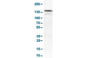Western Blot analysis of RT-4 cell lysates with KIT monoclonal antibody, clone CL1657 . (KIT antibody  (AA 50-190))